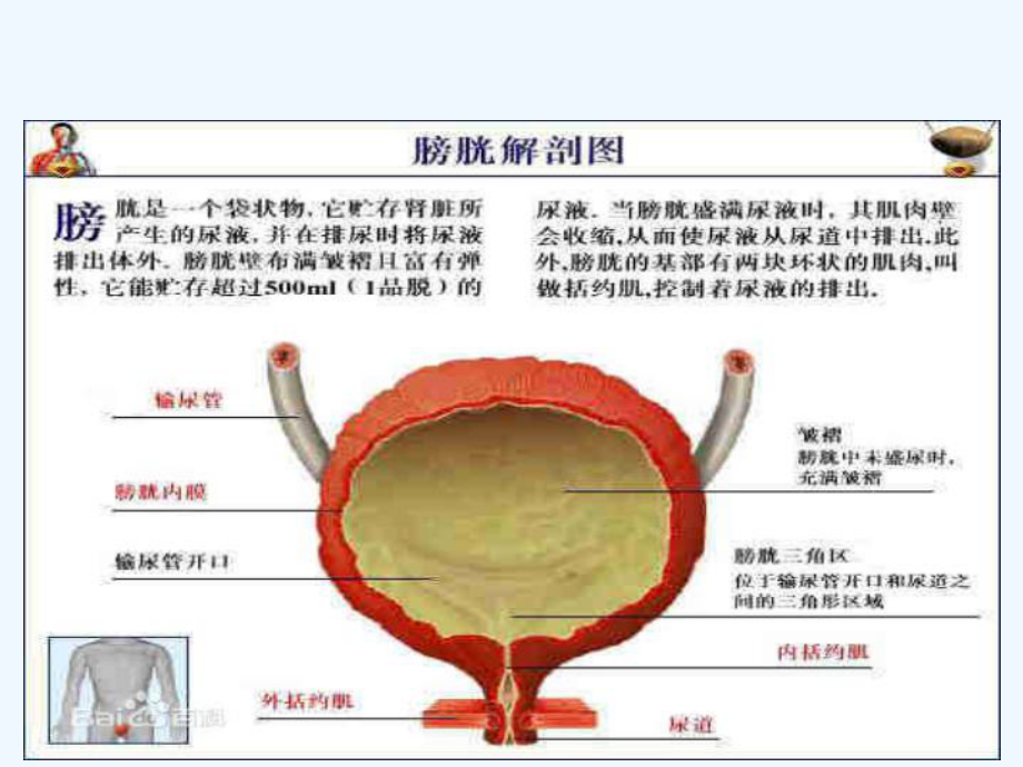 膀胱癌病人的护理及健康教育-课件.ppt_第3页