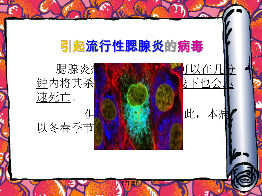 躲开腮腺炎-课件.ppt_第3页