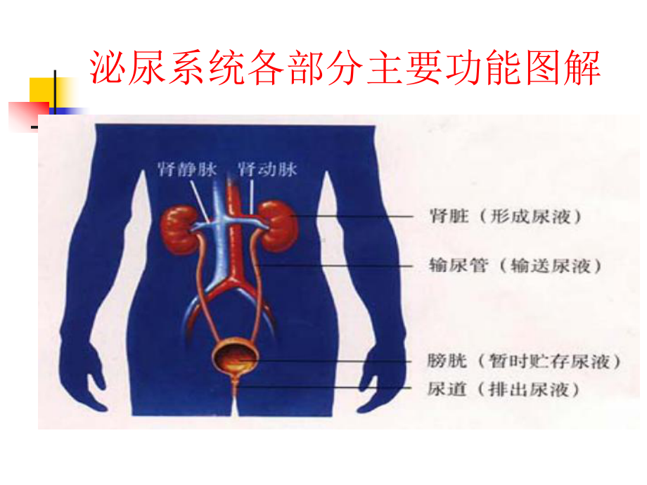 输尿管结石的护理查房-课件.ppt_第3页