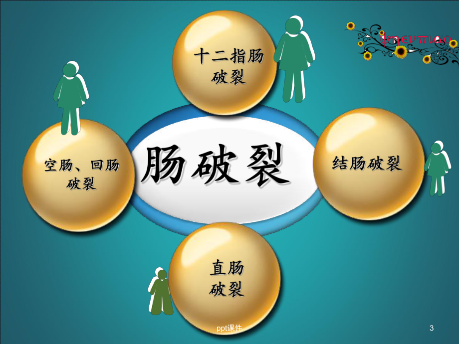 肠破裂的护理-课件.ppt_第3页