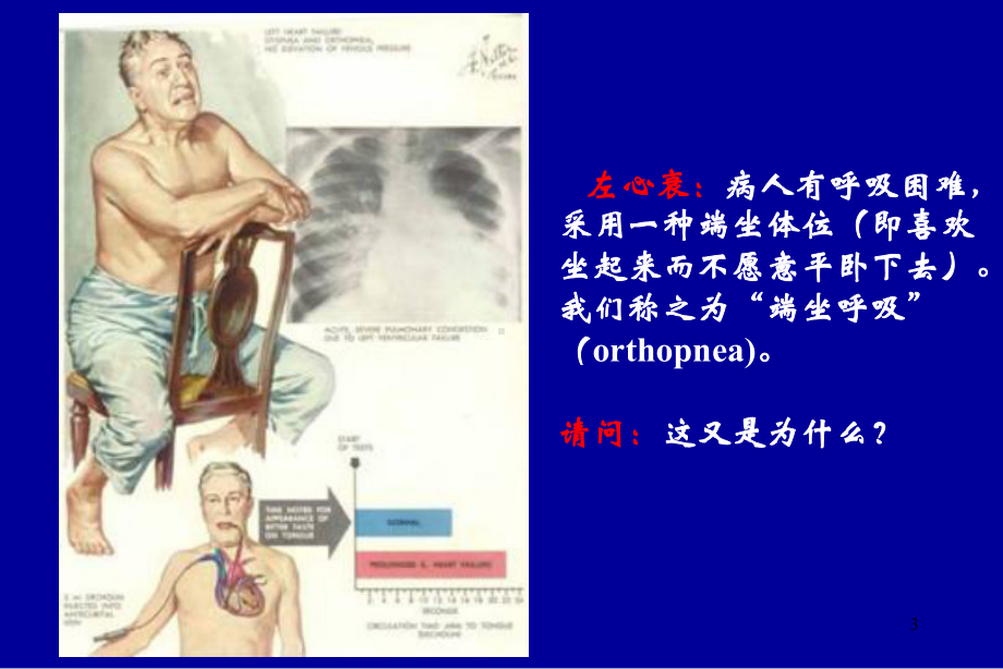 疾病概论-病理学课件.ppt_第3页