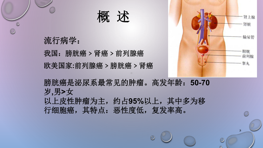 膀胱癌护理查房课件讲义.ppt_第3页