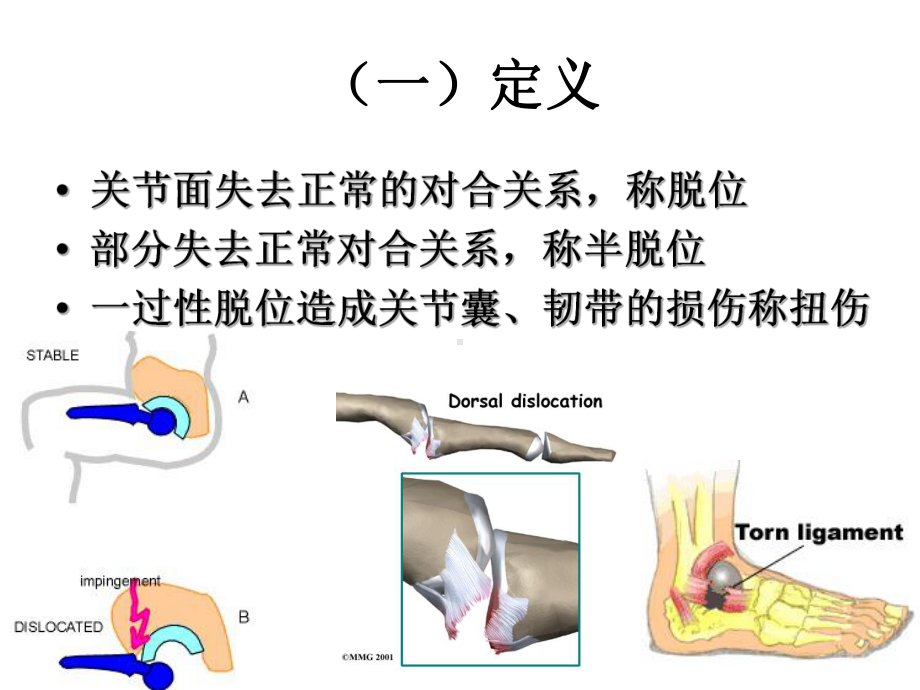 关节脱位课件.ppt_第2页