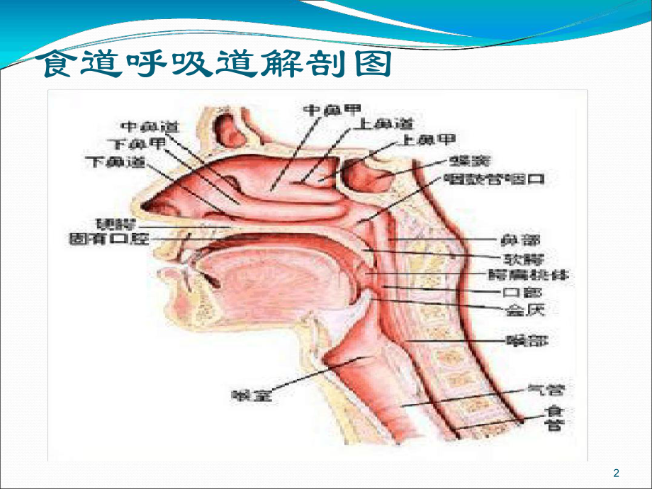 噎食的护理课件.ppt_第2页