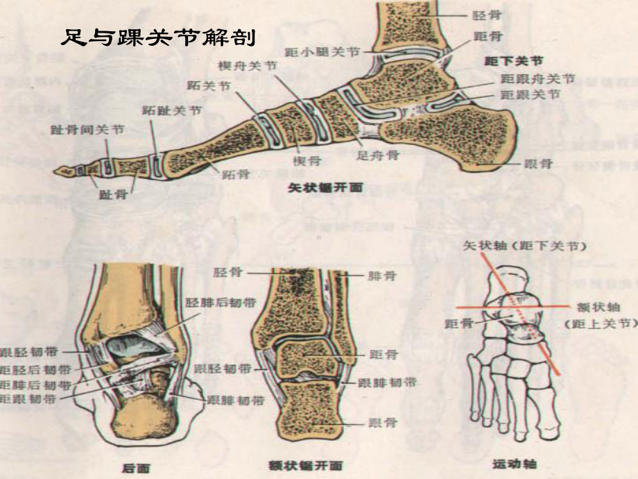 骨科个案踝关节骨折病人的护理课件.ppt_第3页