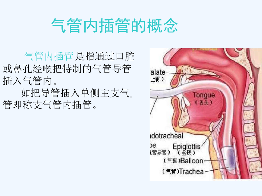 气管插管与肺隔离术课件.ppt_第2页