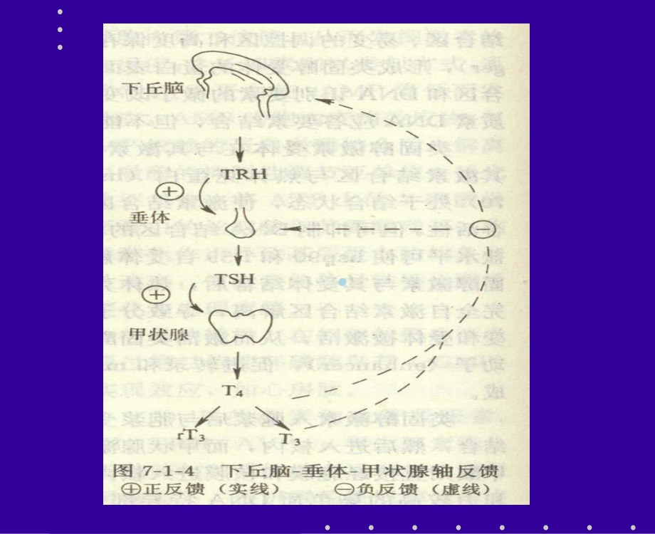 甲亢(秦利)课件.ppt_第3页