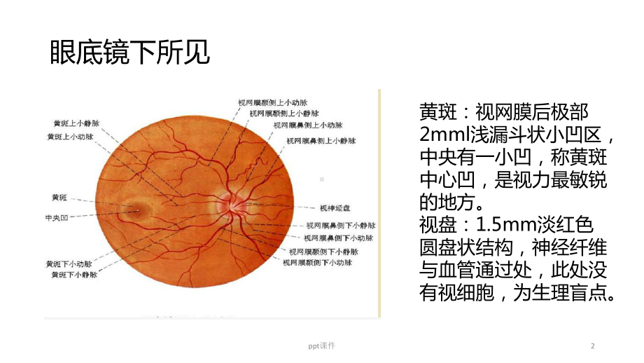 黄斑水肿护理查房-课件.ppt_第2页