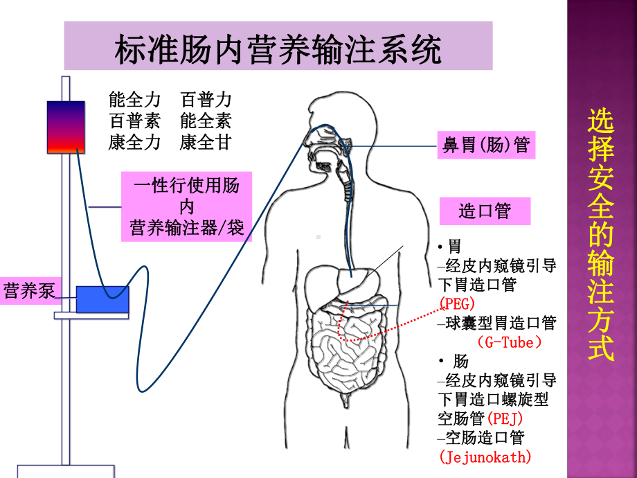 肠内营养并发症处理-课件.ppt_第2页