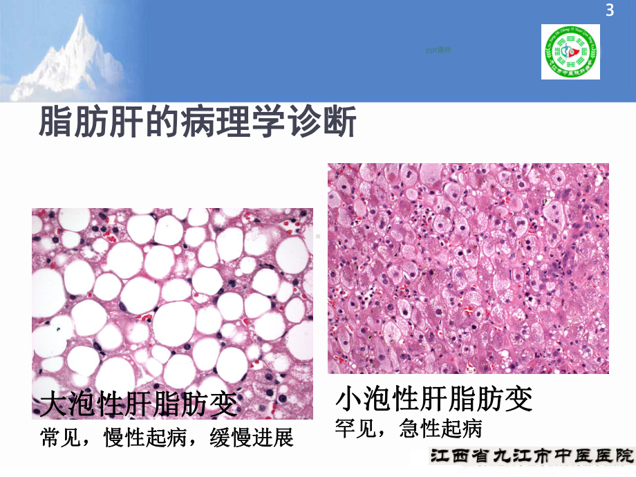 非酒精性脂肪性肝病防治指南-课件.ppt_第3页