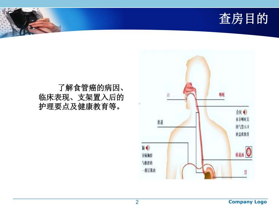 食管癌支架置入护理查房课件.ppt_第2页