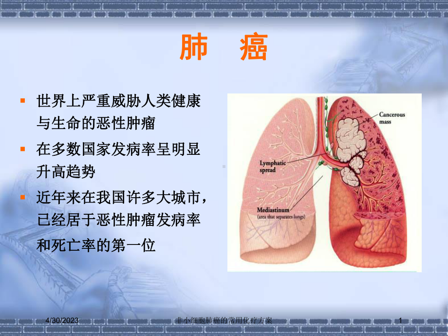 非小细胞肺癌的常用化疗方案培训课件.ppt_第1页