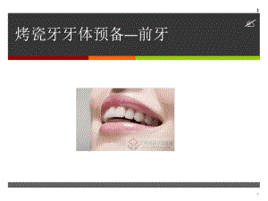 烤瓷牙牙体预备参考教学课件.ppt