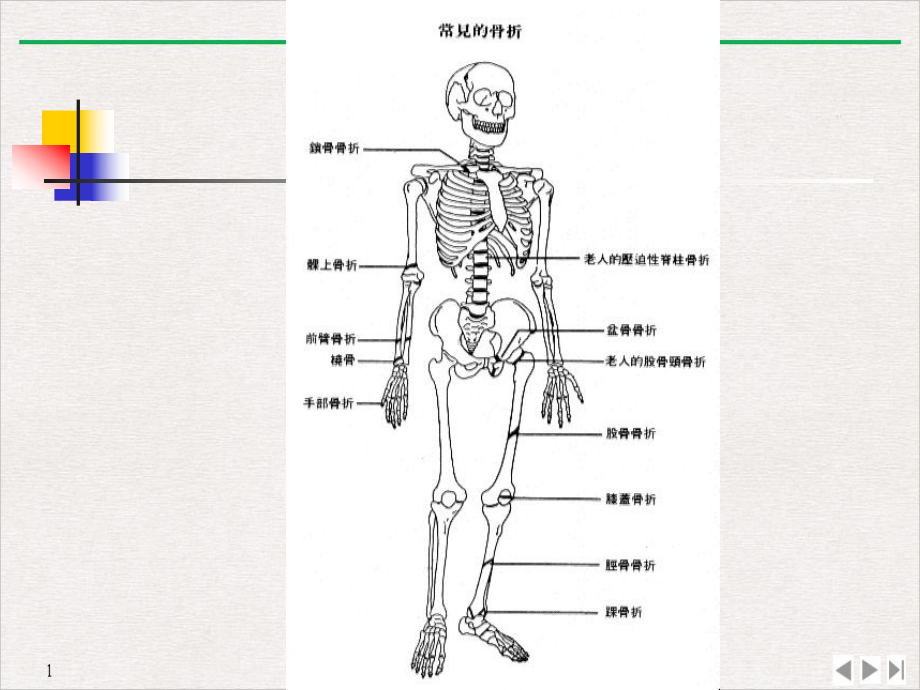 骨与关节损伤病人的护理(最新版)课件.ppt_第2页