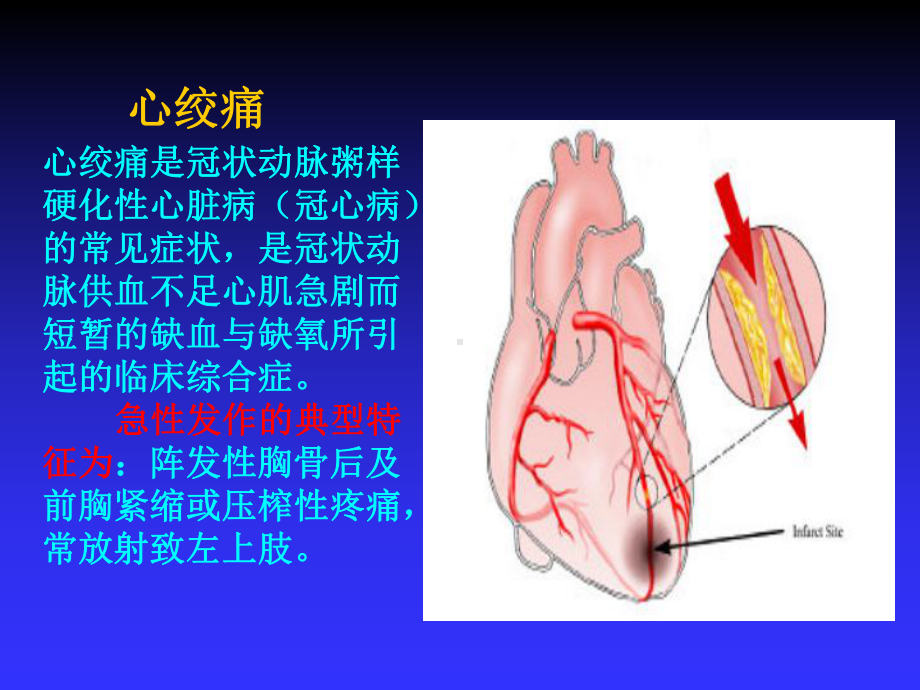 第四节-抗心绞痛药-课件.ppt_第3页