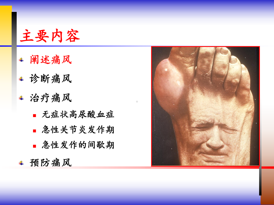 痛风诊治课件.ppt_第2页