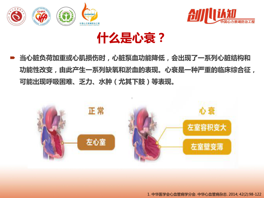 正确认识心衰培训课件.ppt_第3页