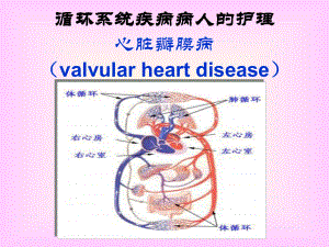 内科循环系统疾病病人的护理第三章06节本瓣膜病.pptx