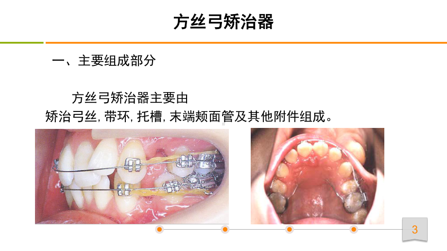 口腔正畸学：方丝弓矫治器主要组成部分.pptx_第3页