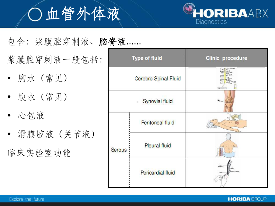 体液检测最新版课件.ppt_第3页