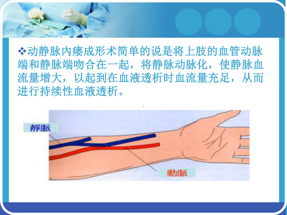 动静脉内瘘护理查房资料讲解课件.ppt_第2页