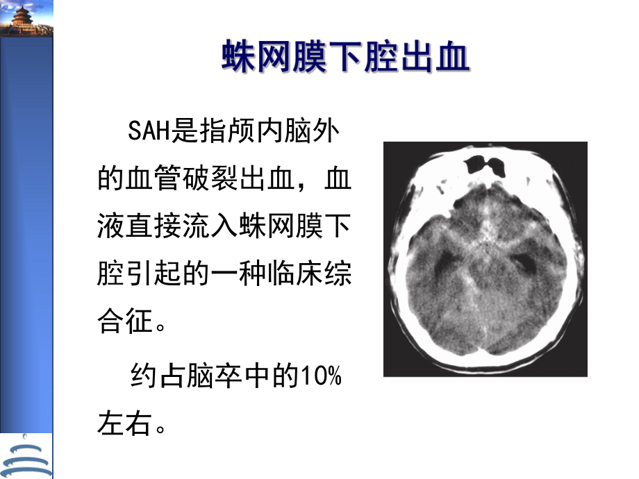 动脉瘤性蛛网膜下腔出血处理指南课件.ppt_第2页