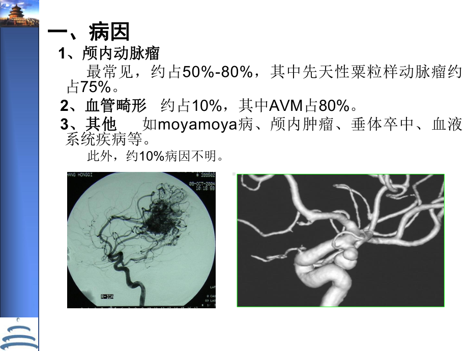 动脉瘤性蛛网膜下腔出血处理指南课件.ppt_第3页