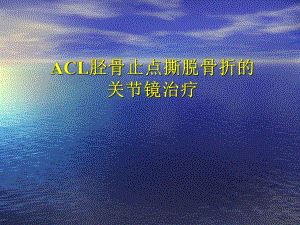 ACL胫骨止点撕脱骨折的关节镜治疗课件.ppt