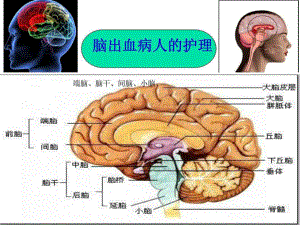 -脑出血的护理课件.ppt