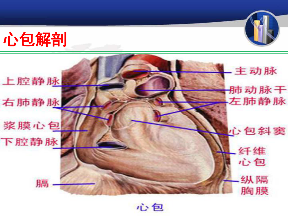 心包积液及心包填塞.ppt_第2页