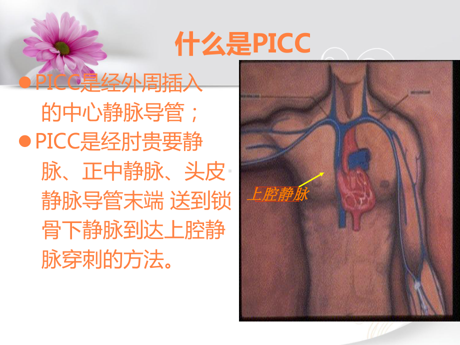 PICC置管与护理课件.ppt_第3页