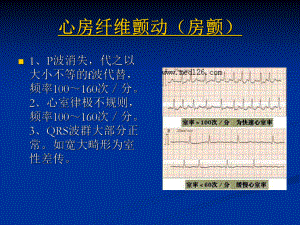 各种心电图表现 .ppt