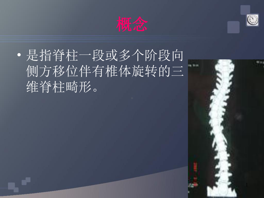 三维脊柱畸形课件.ppt_第1页