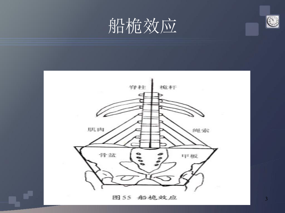 三维脊柱畸形课件.ppt_第3页