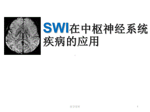 SWI在中枢神经系统疾病的应用-课件.ppt