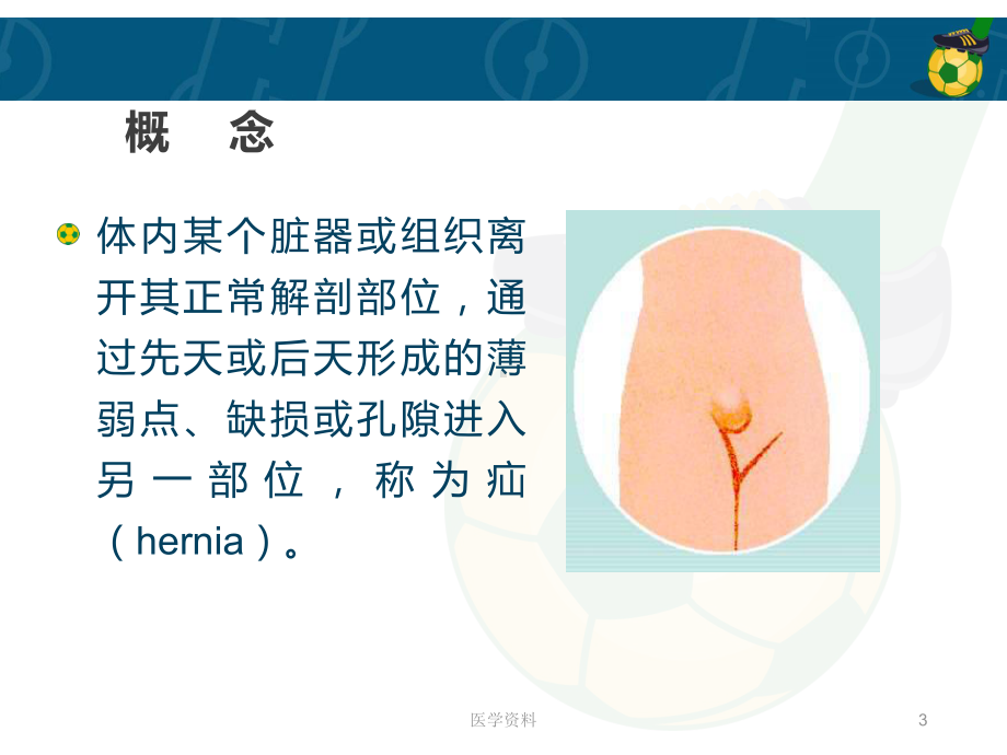 《外科学》腹外疝-课件(同名22).ppt_第3页