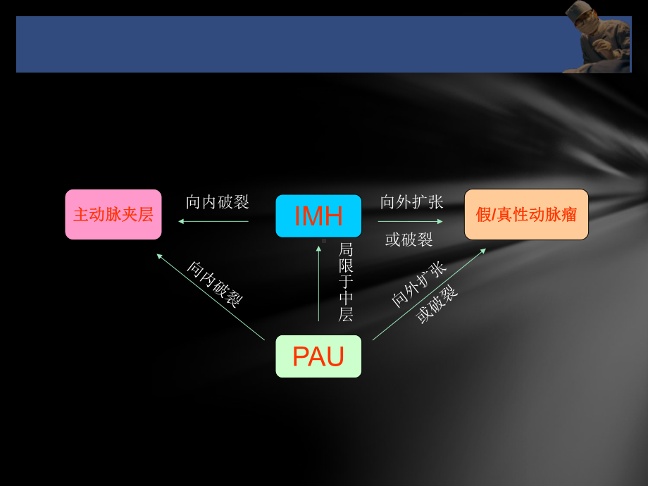 主动脉夹层、壁间血肿及穿通性溃疡课件.ppt_第3页