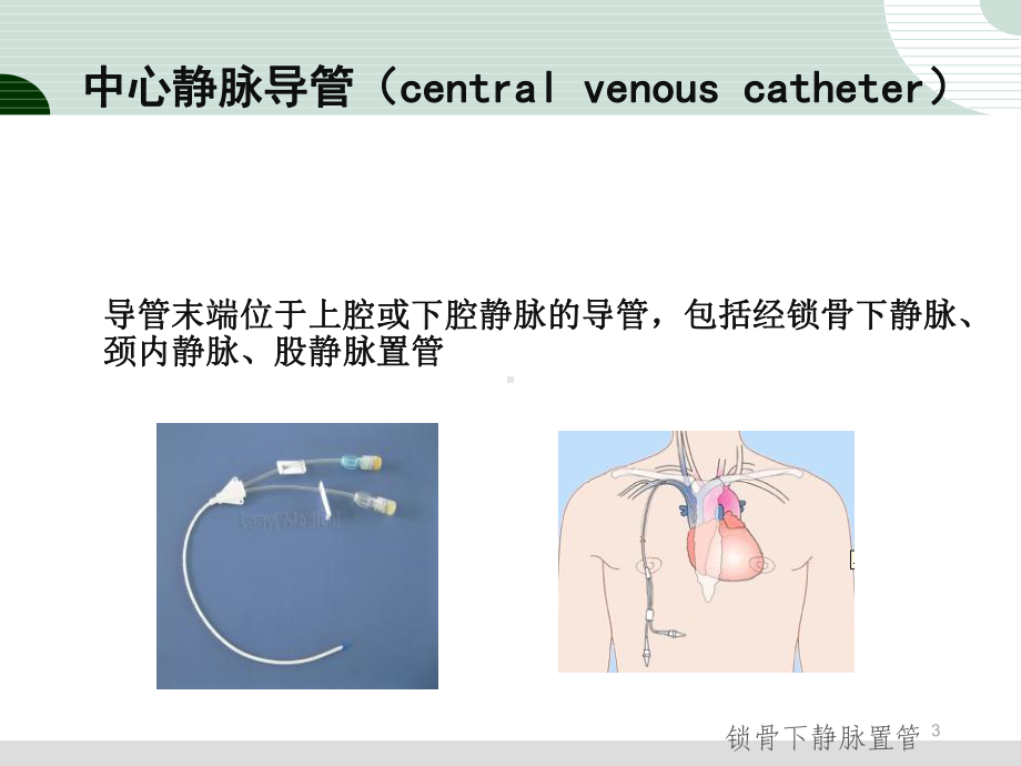 中心静脉导管的维护课件-参考.ppt_第3页