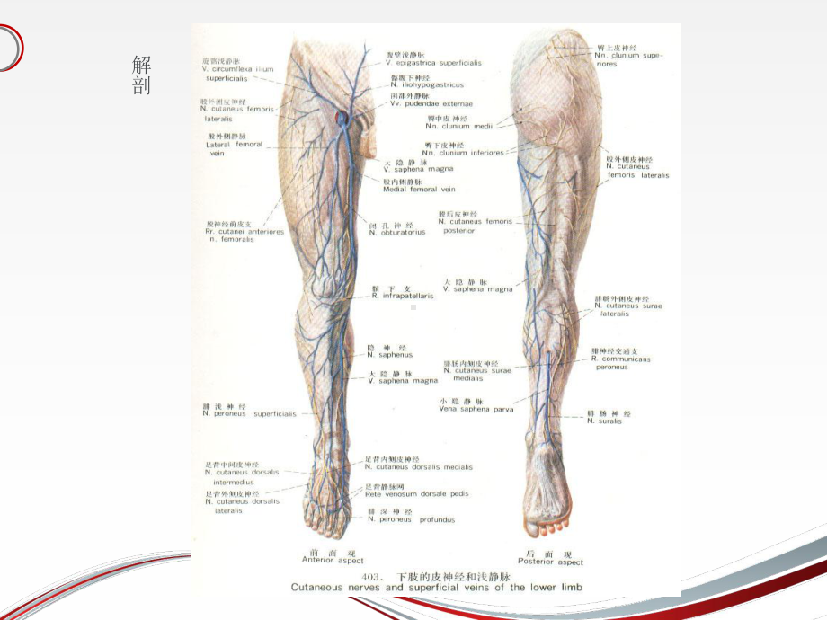 下肢大隐静脉曲张的护理-课件.ppt_第3页