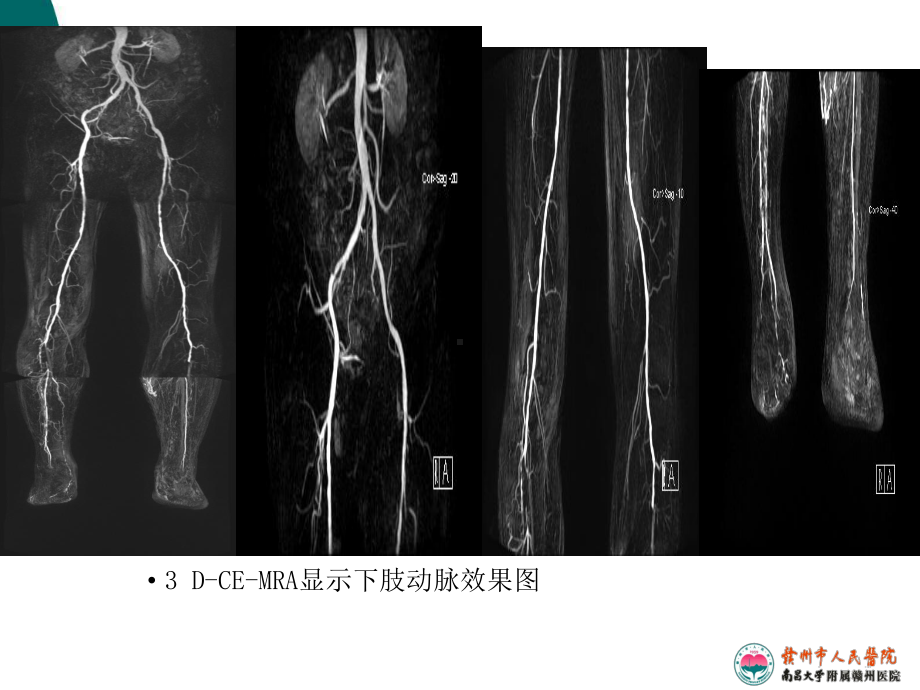 下肢血管超声规范检查与诊断(同名129)课件.ppt_第3页