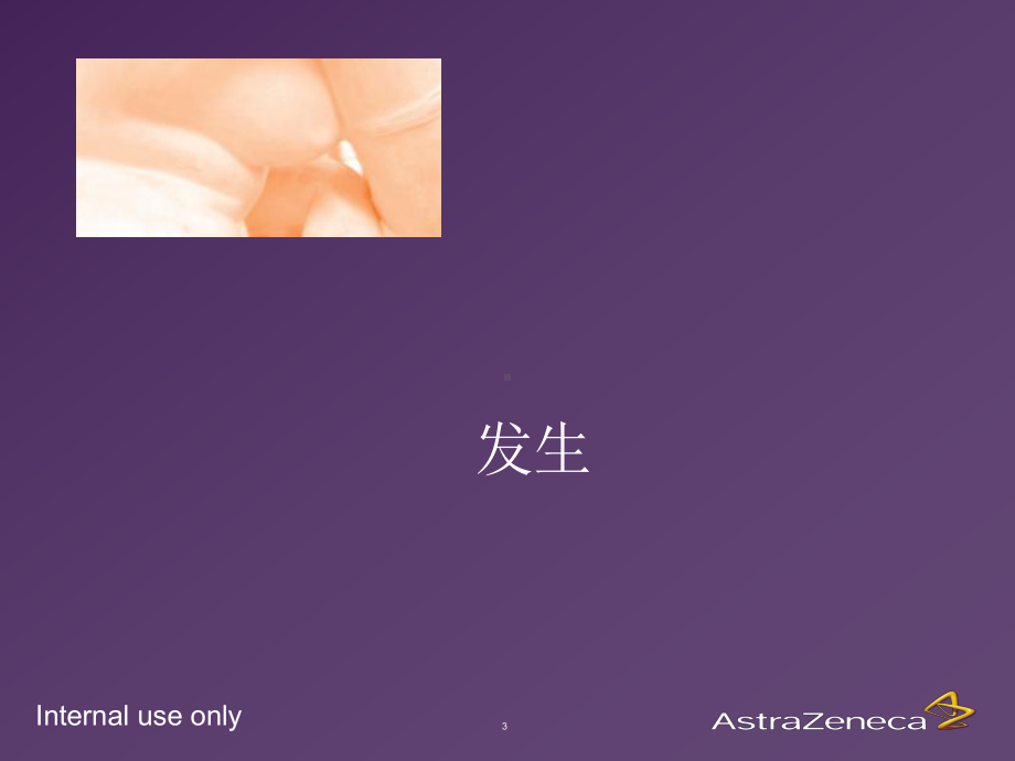 乳腺癌基础知识课件.ppt_第3页