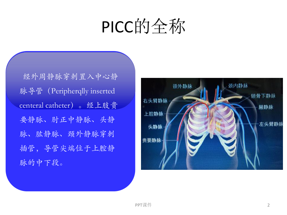 PICC置管患者的护理-课件.pptx_第2页