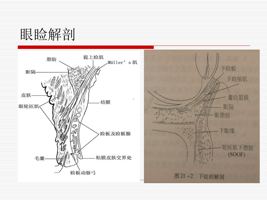 上睑下垂-课件.ppt_第2页