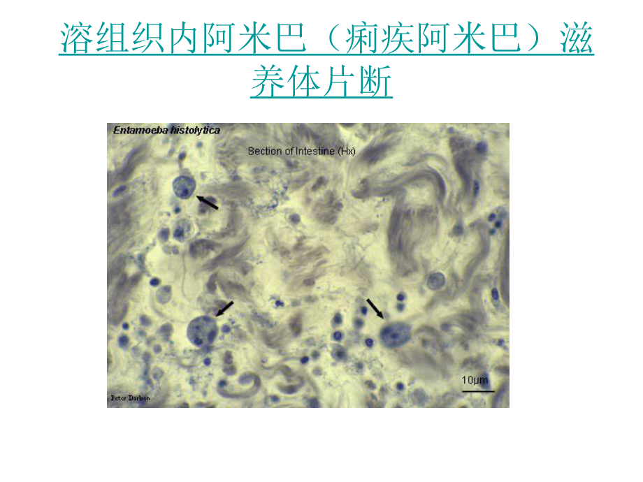 （大学课件）常见寄生虫图谱.ppt_第3页