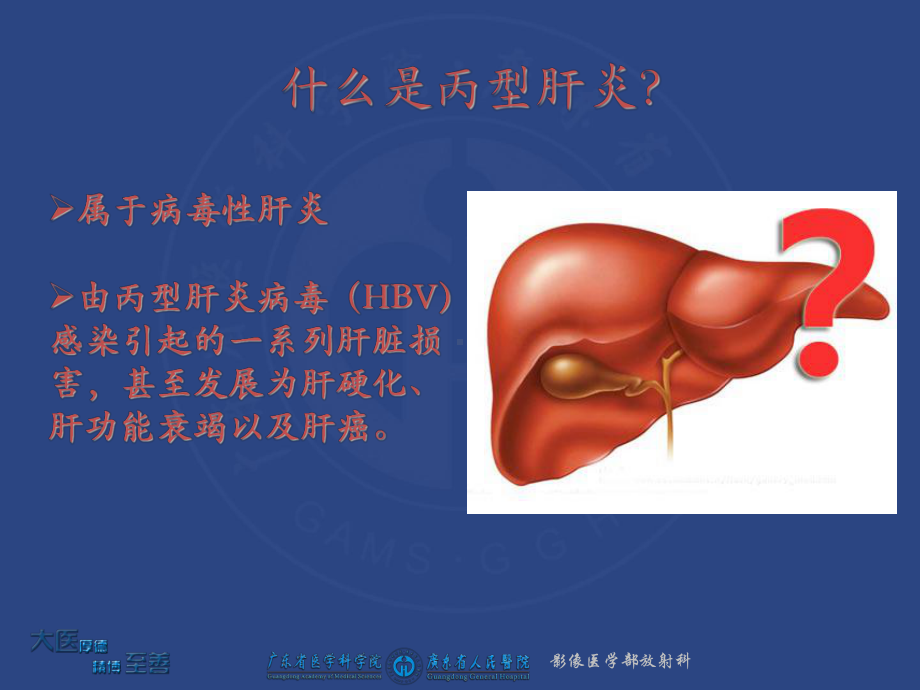 丙型肝炎基础知识课件.ppt_第2页