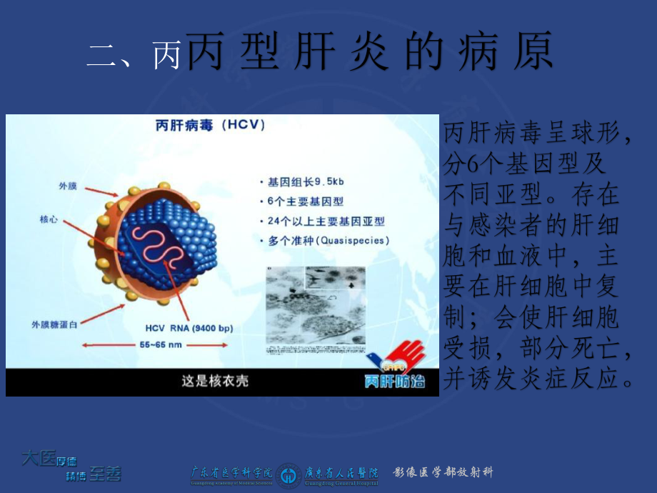 丙型肝炎基础知识课件.ppt_第3页