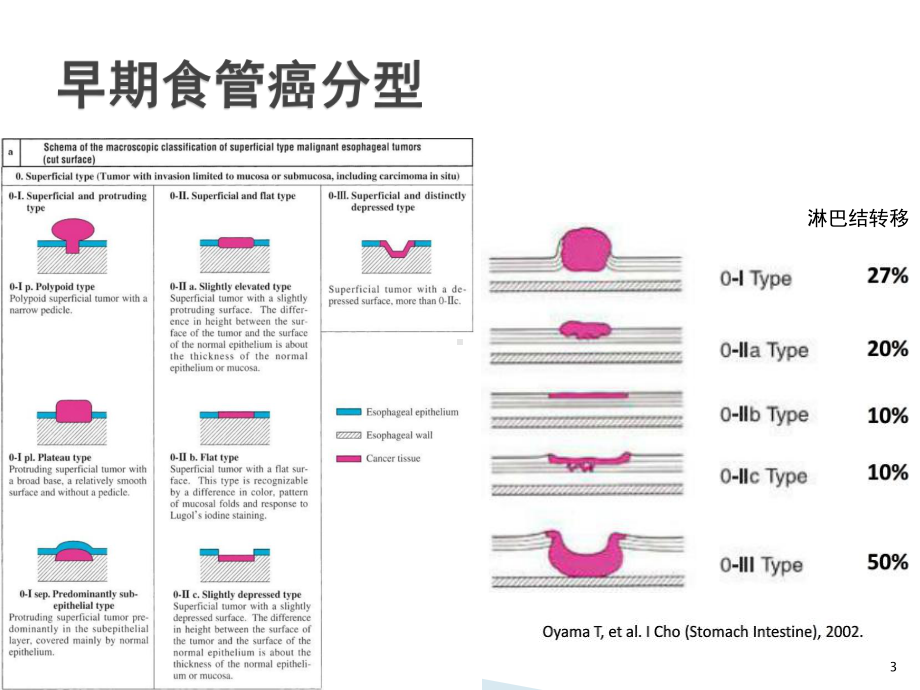 NBI+放大在食管早癌诊断中的应用进展-课课件.ppt_第3页