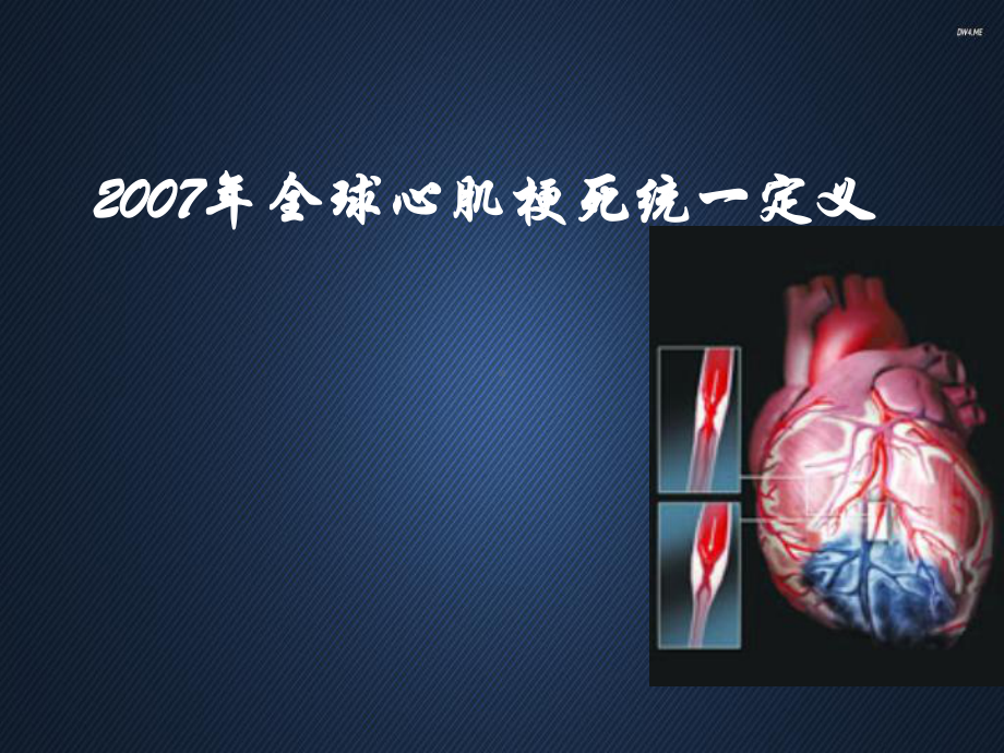 全球心肌梗死统一定义-课件.ppt_第1页