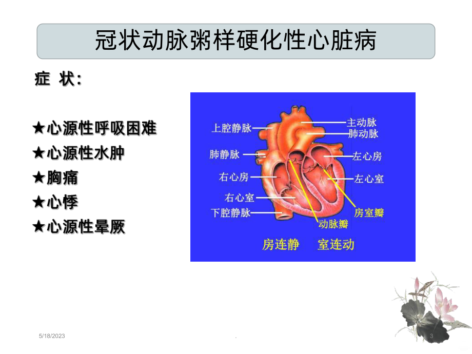 冠状动脉粥样硬化性心脏病护理查房课件(同名873).ppt_第3页