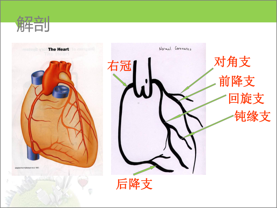 体外循环下冠脉搭桥术-课件.ppt_第3页